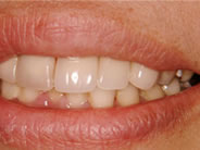 �N���E���u���b�W1�ʐ^2