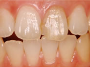 �N���E���u���b�W2�ʐ^1