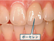 �N���E���u���b�W2�ʐ^2