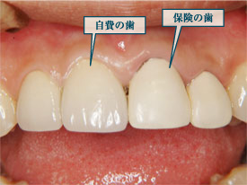 �N���E���u���b�W4�ʐ^1