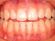 �N���E���u���b�W1�ʐ^2