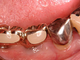 �C���v�����g1�摜1