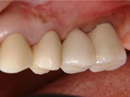 �C���v�����g2�摜1