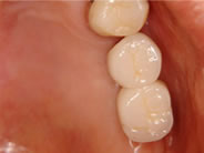 �C���v�����g2�摜2