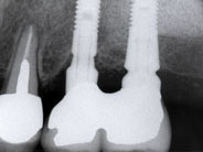 �C���v�����g2�摜3