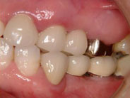 �C���v�����g4�摜2