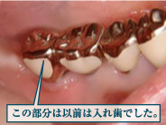 �C���v�����g5�摜1