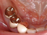 �C���v�����g5�摜2