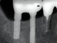 �C���v�����g5�摜3