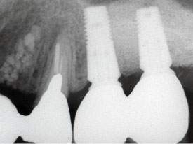 �C���v�����g6�摜2