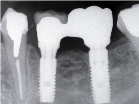 �C���v�����g7�摜2