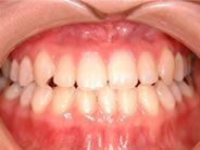 ��������1�ʐ^2