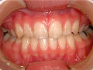 ��������2�ʐ^2