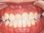 ��������3�ʐ^1