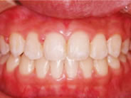 ��������3�ʐ^2