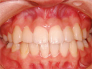 ��������4�ʐ^2