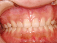 ��������5�ʐ^3