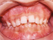 ��������5�ʐ^1