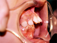 ��������5�ʐ^2