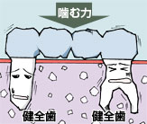 �������Ԃ�2�{�������ꍇ