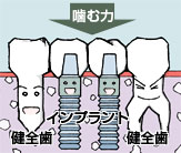 �������Ԃ�2�{�������ꍇ