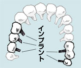 �������Ԃ�2�{�������ꍇ